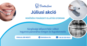 2026 júliusi akció
